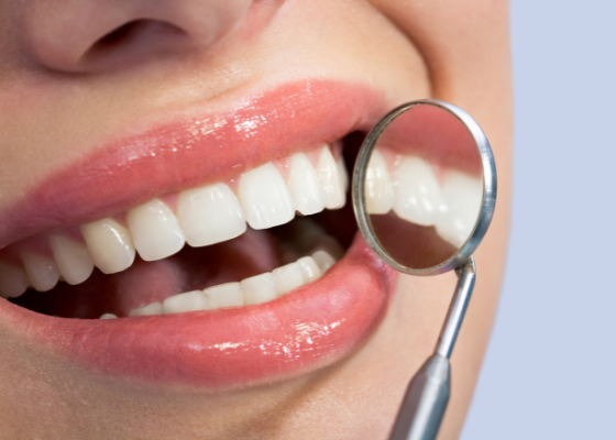 a képen mosolygó női száj kristálytiszta fogakkal